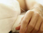 West Orange Acupuncture FAQ