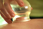 cupping-chinese-therapy