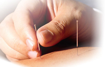 Acupuncture Essex County Steven Goldfarb